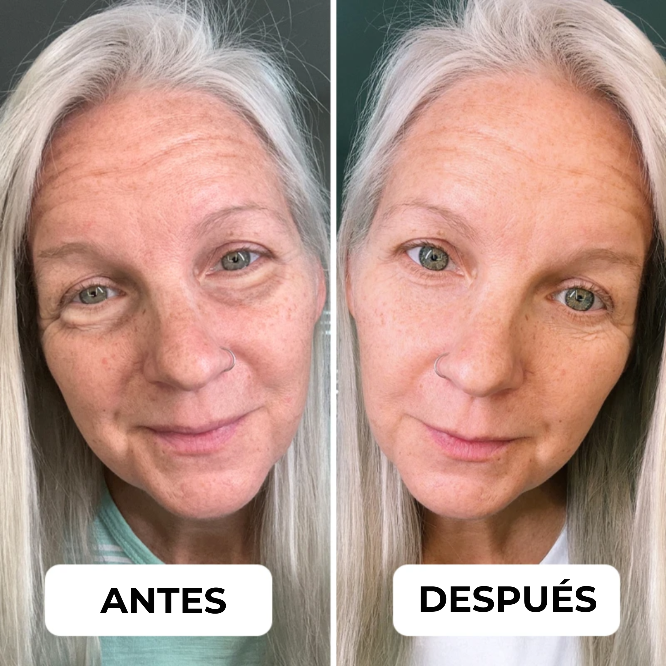 EyePods™ – El tratamiento definitivo para el contorno de tus ojos