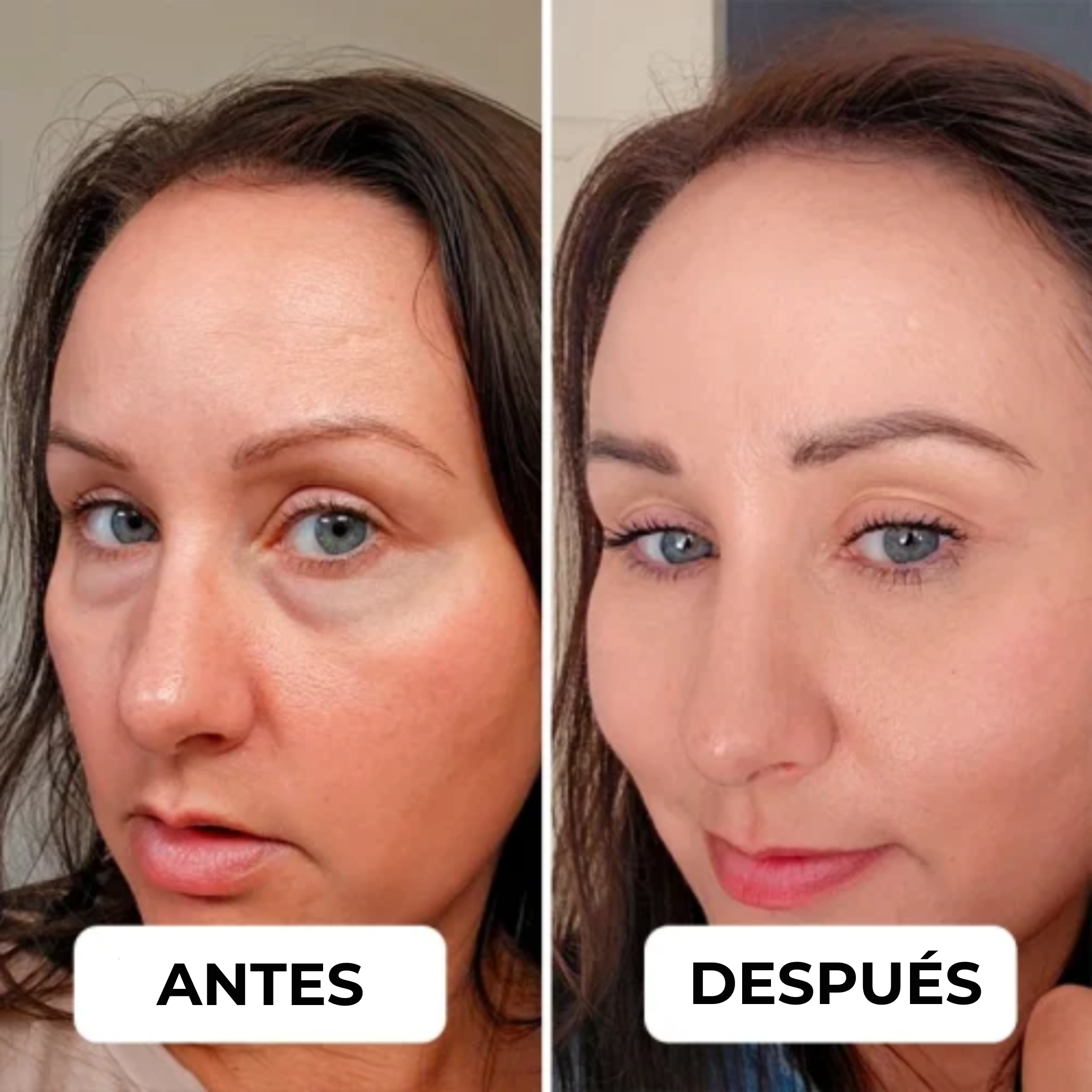 EyePods™ – El tratamiento definitivo para el contorno de tus ojos