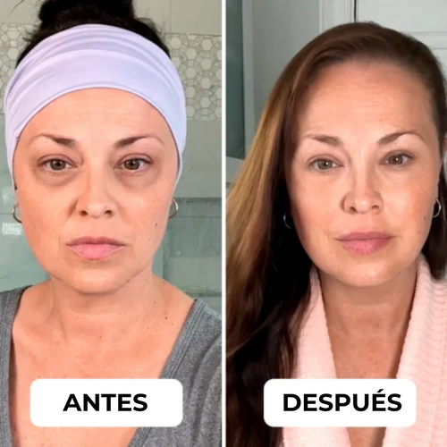 EyePods™ – El tratamiento definitivo para el contorno de tus ojos